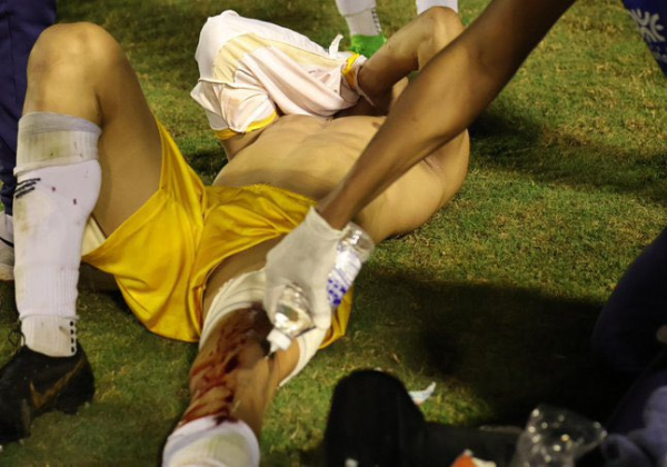 Goleiro é atingido por bala de borracha após confusão no Campeonato…
