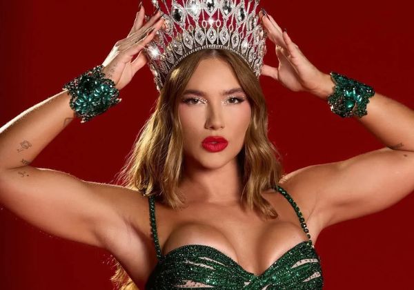 Virginia exibe feridas causadas por fantasia de Carnaval; confira