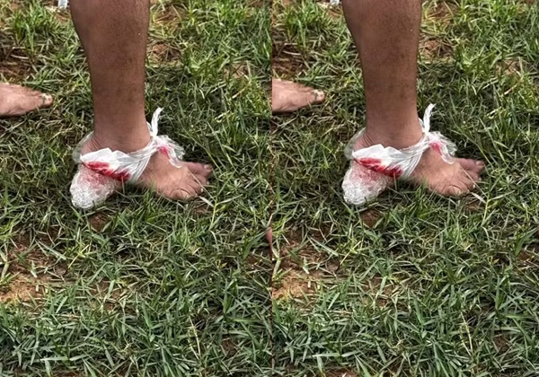 Ataque de piranhas deixa feridos em rio de cidade baiana