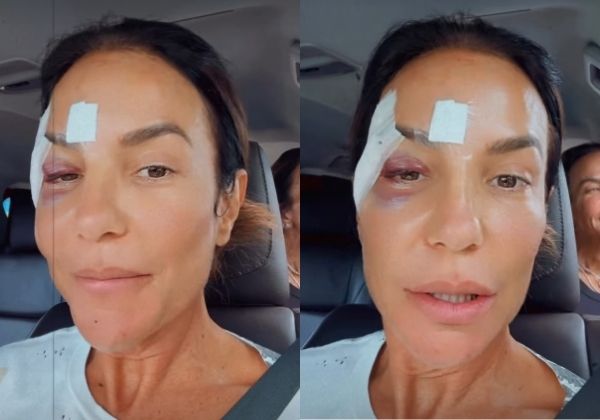 VÍDEO: Ivete Sangalo recebe alta após mal-estar e queda