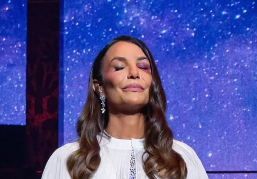 Ivete Sangalo passa por cirurgia de quase 7 horas após desmaio