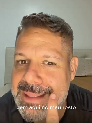 Cantor baiano Danniel Vieira fala sobre câncer de pele